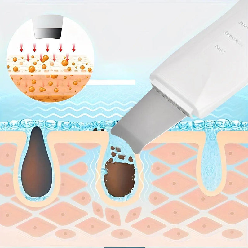 Peeling Ultrassônico Limpador Facial Portátil